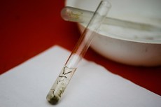 Ainda é necessário comprovar cientificamente a ligação entre infecções pelo vírus Zika em gestantes e casos de microcefalia em bebês